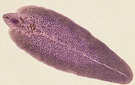 contoh simbiosis parasitisme antara manusia dan cacing pita